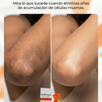 🔥Dr . MELAXIN™ Aclara, Exfolia e Hidrata al Instante